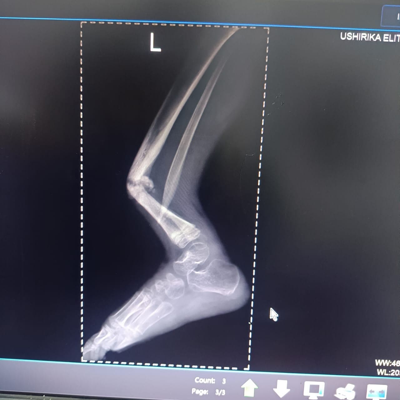 Impact story photo 1