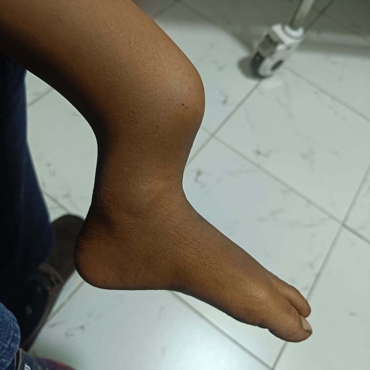 Impact story photo 2